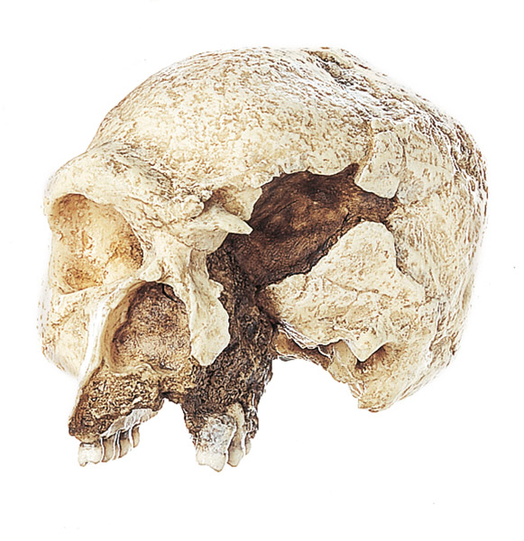 The Steinheim Skull. Homo sapiens steinheimensis.